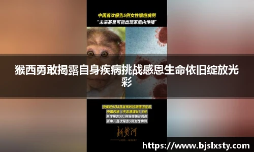 猴西勇敢揭露自身疾病挑战感恩生命依旧绽放光彩